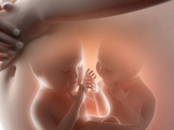 双胎妊娠并发症